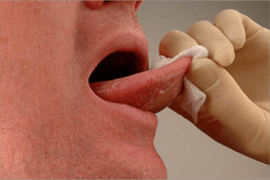 Mouth Cancer Screening